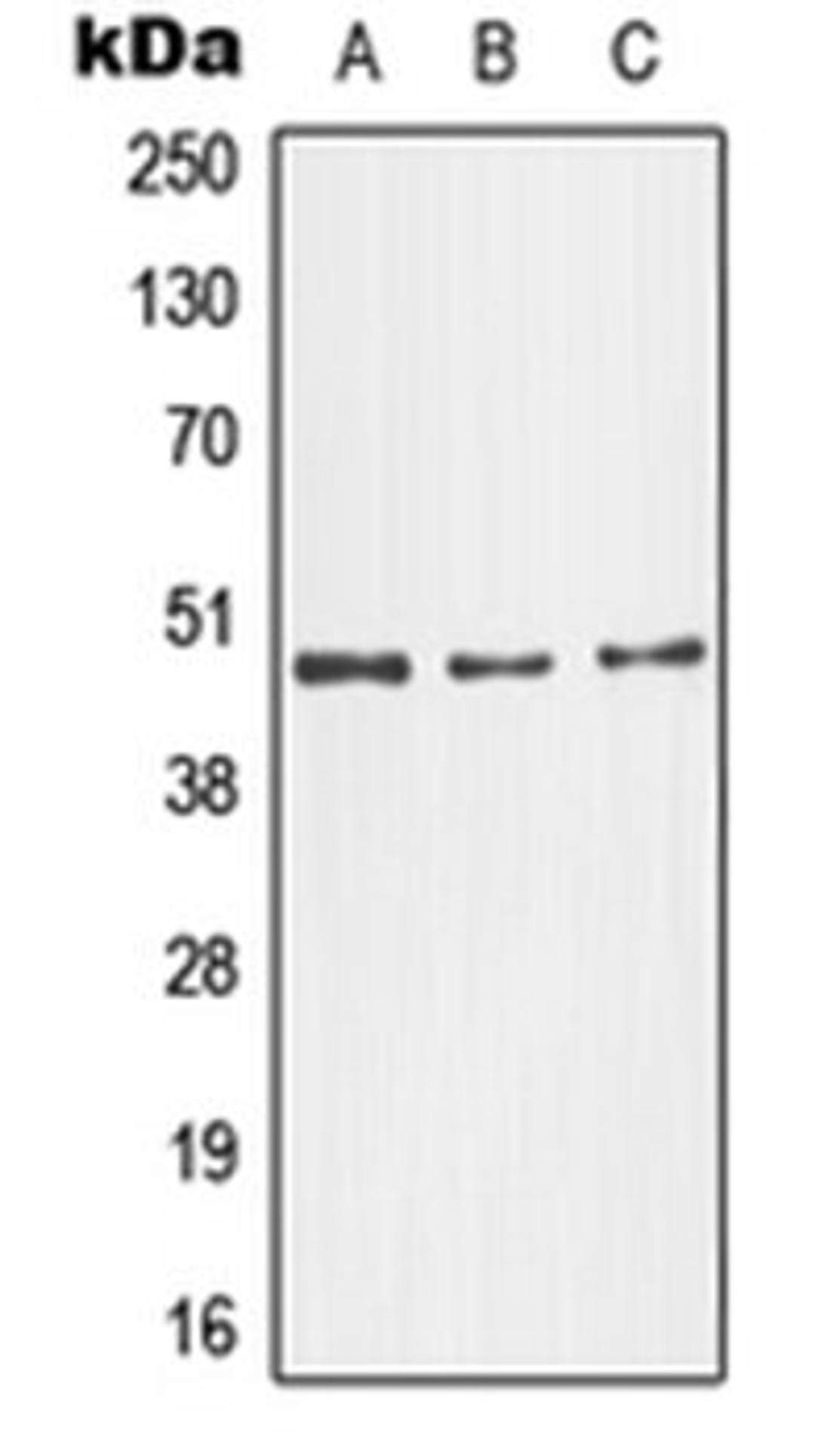 Western blot analysis of NIH3T3 (Lane 1), SKNSH (Lane 2), HeLa (Lane 3) whole cell lysates using MAPK10 antibody