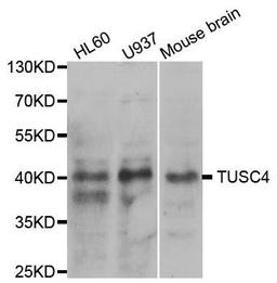 Western blot analysis of extracts of various cell lines using TUSC4 antibody