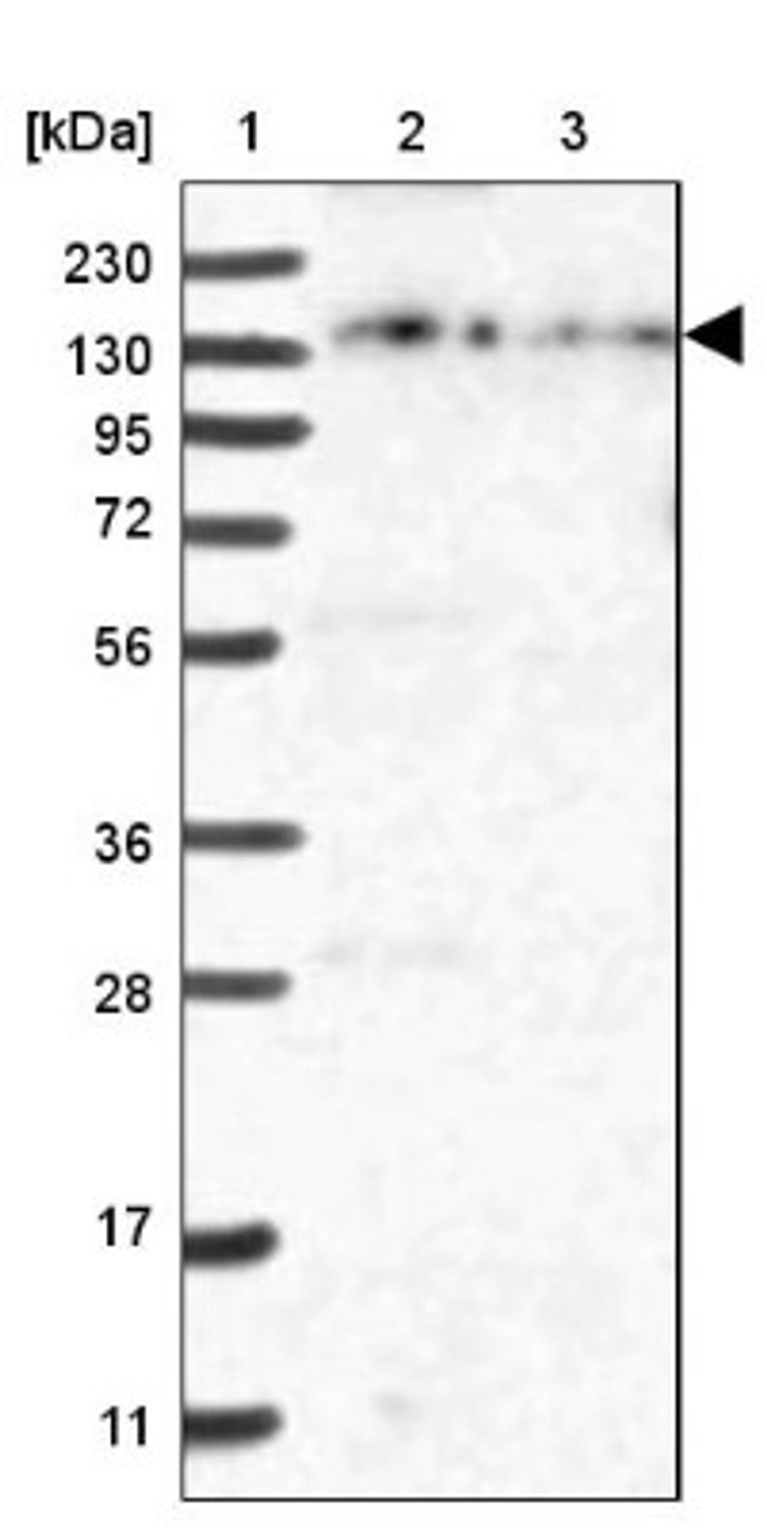 Western Blot: ZFYVE16 Antibody [NBP1-81516] - Lane 1: Marker [kDa] 230, 130, 95, 72, 56, 36, 28, 17, 11<br/>Lane 2: Human cell line RT-4<br/>Lane 3: Human cell line U-251MG sp