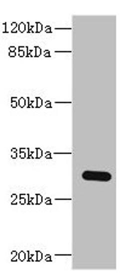 Western blot. All lanes: BPGM antibody at 2.87µg/ml + Human placenta tissue. Secondary. Goat polyclonal to rabbit IgG at 1/10000 dilution. Predicted band size: 30 kDa. Observed band size: 30 kDa