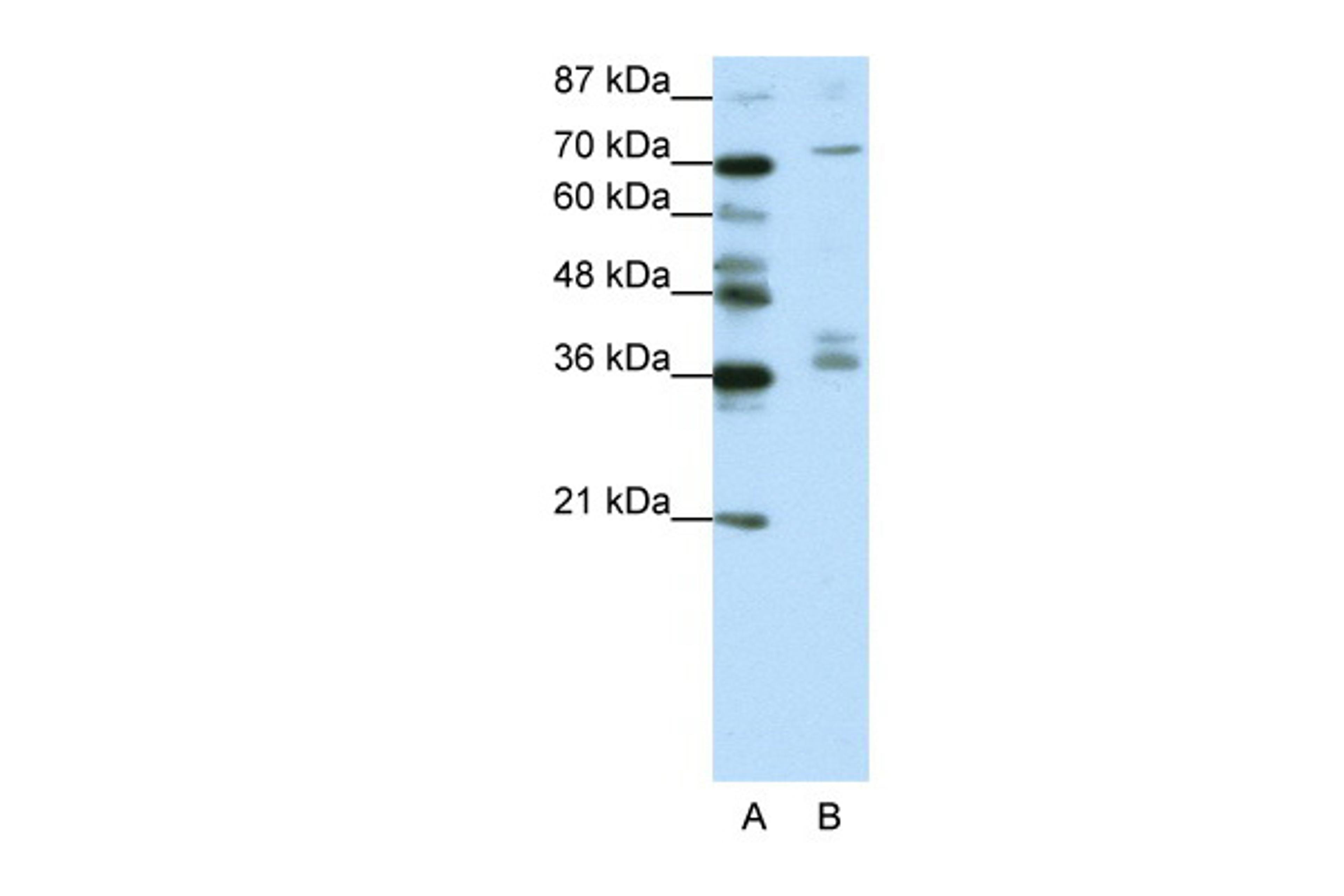 Antibody used in WB on Human Jurkat 1.25 ug/ml.