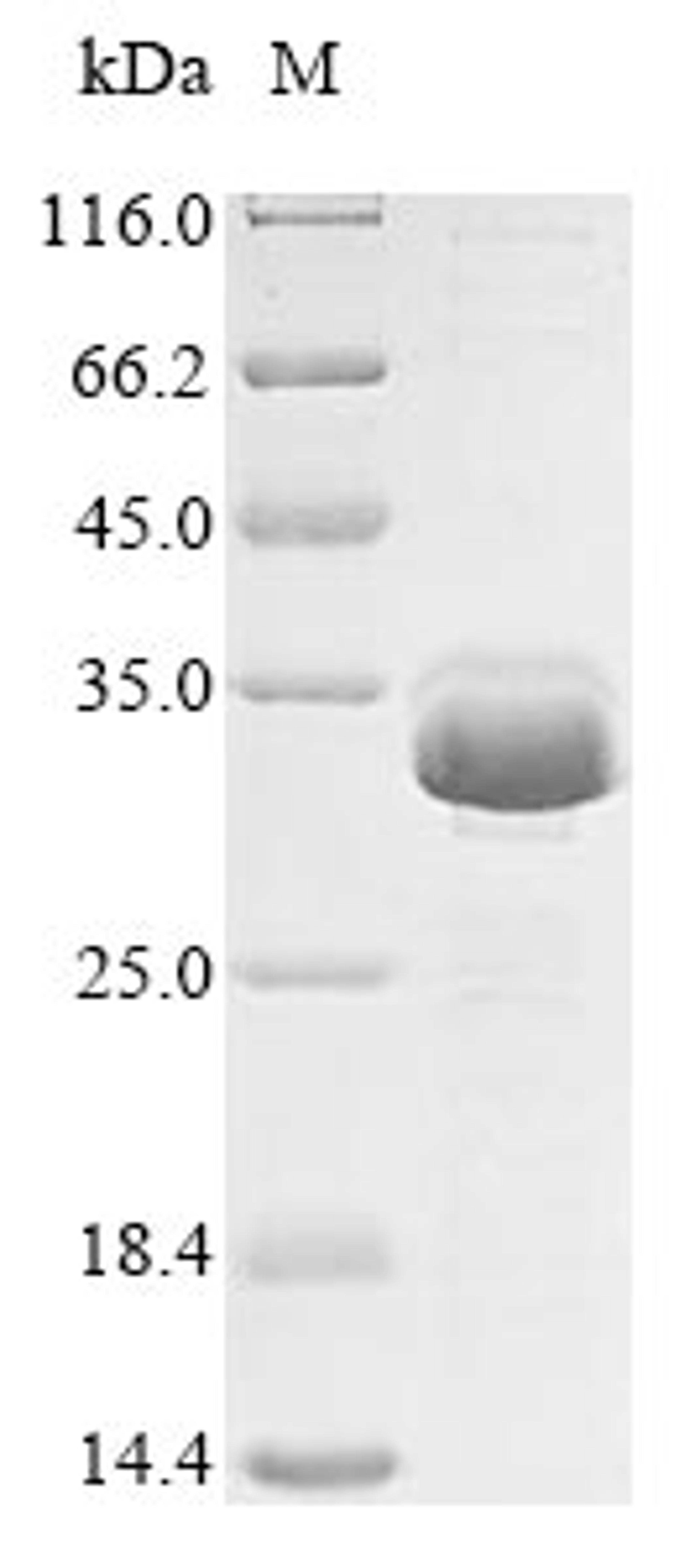 (Tris-Glycine gel) Discontinuous SDS-PAGE (reduced) with 5% enrichment gel and 15% separation gel.