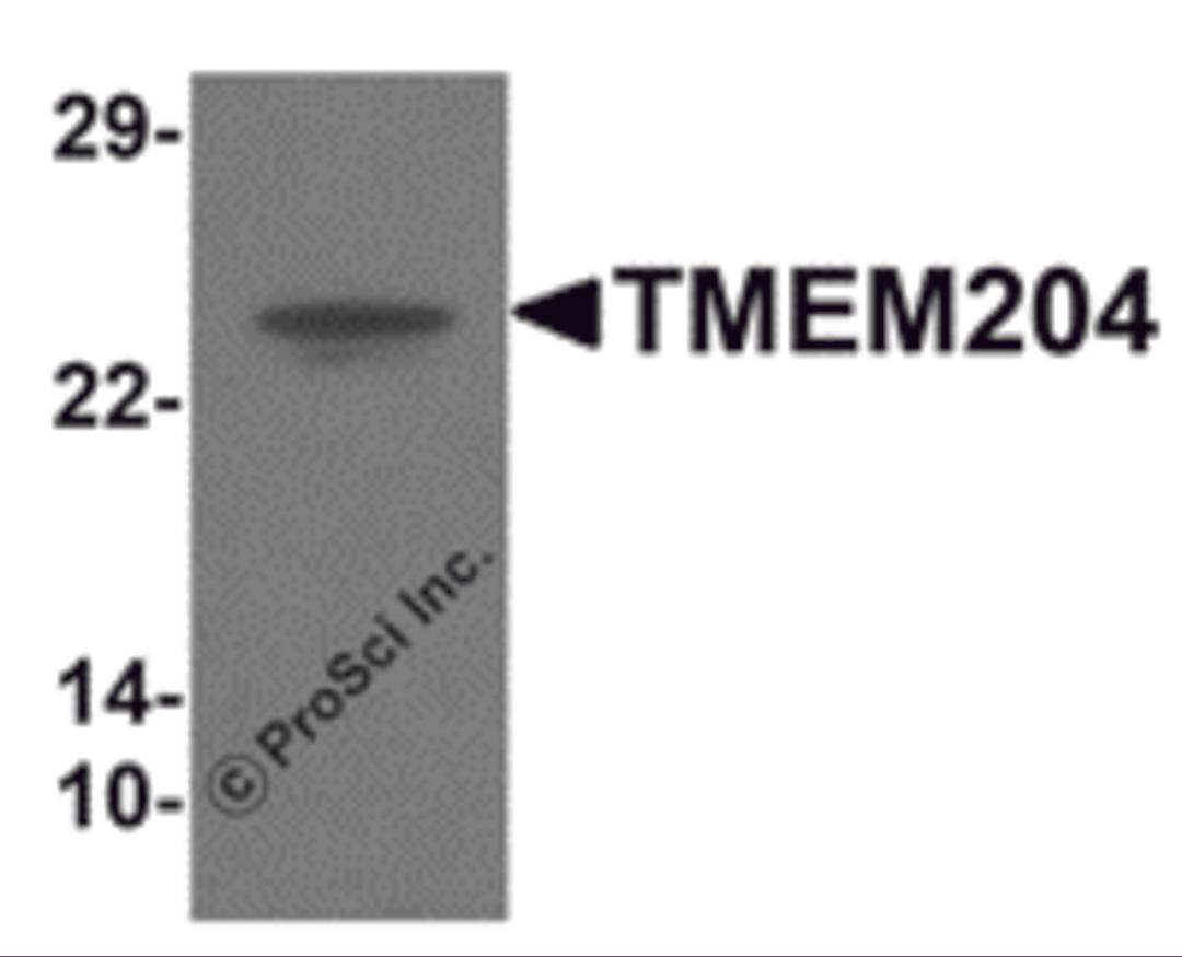 Western blot analysis of TMEM204 in human brain tissue lysate with TMEM204 antibody at 1 &#956;g/mL .