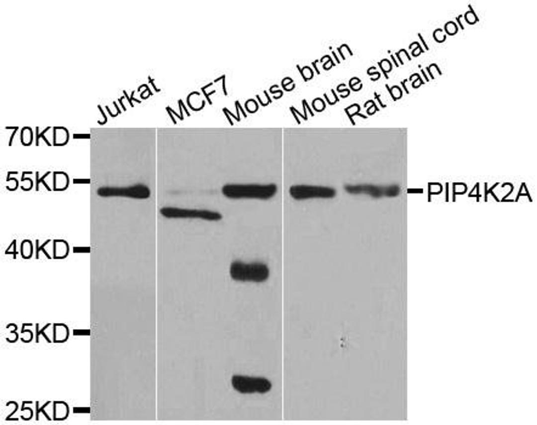 Western blot analysis of extracts of various cell lines using PIP4K2A antibody