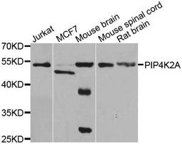 Western blot analysis of extracts of various cell lines using PIP4K2A antibody