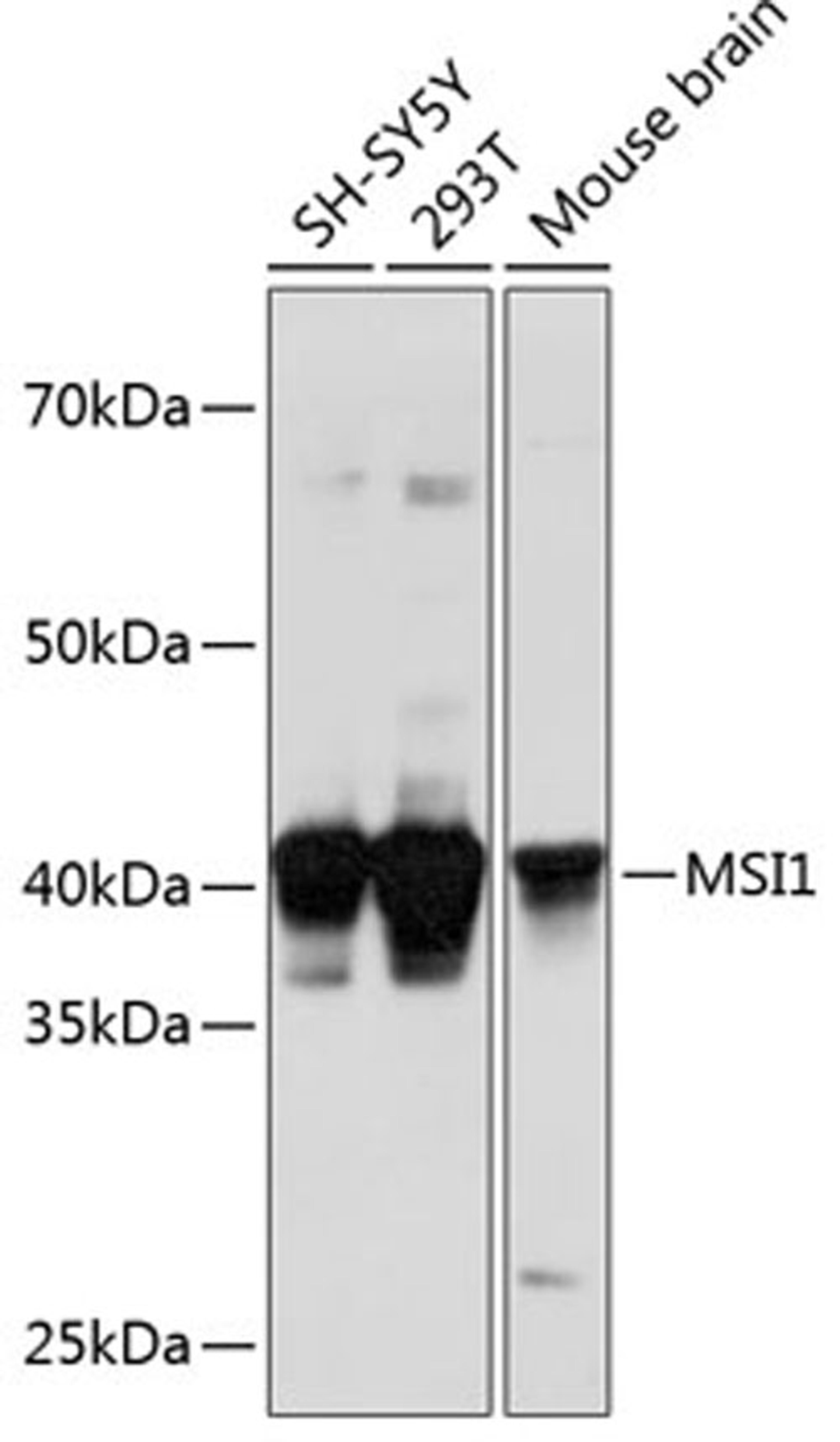 Western blot - MSI1 Polyclonal Antibody (A2609)