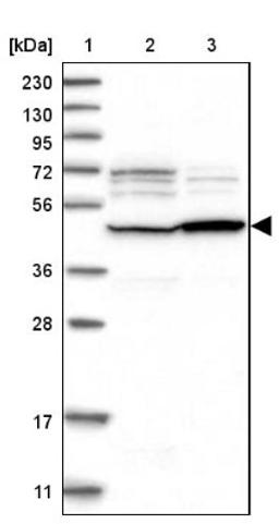 Western Blot: GCNT2 Antibody [NBP1-88781] - Lane 1: Marker [kDa] 230, 130, 95, 72, 56, 36, 28, 17, 11<br/>Lane 2: Human cell line RT-4<br/>Lane 3: Human cell line U-251MG sp