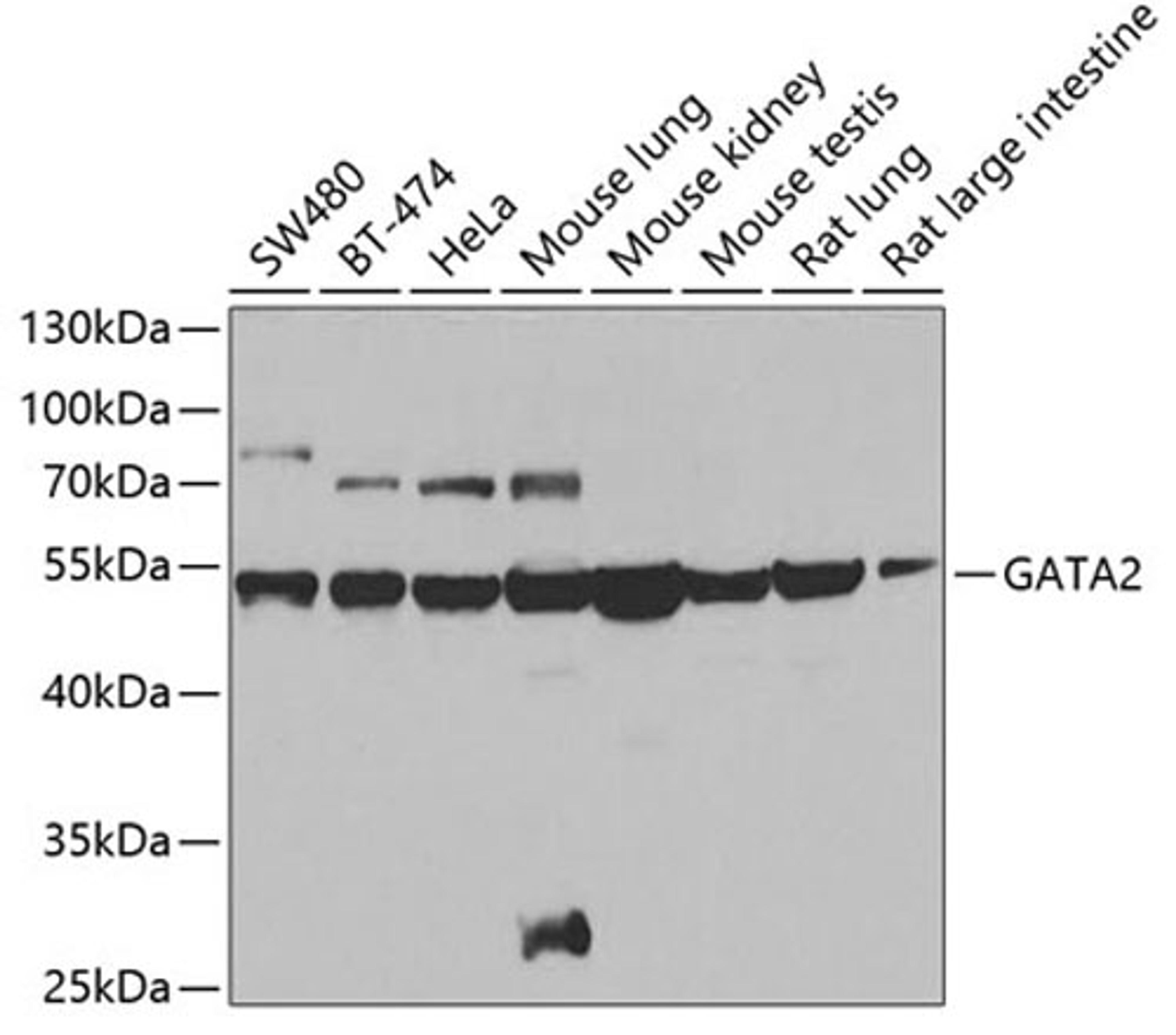 Western blot - GATA2 antibody (A0677)