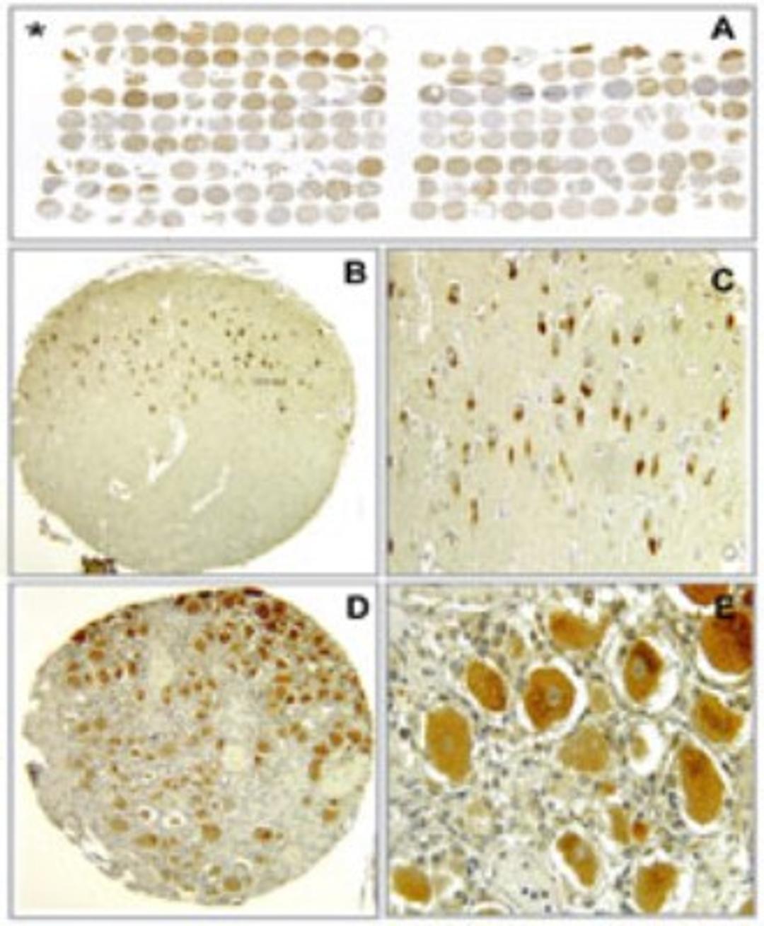 Immunohistochemistry-Paraffin: Bax inhibitor 1 Antibody (20F565) [NBP2-24912] - analysis of Bi-1 using Bi-1 antibody at 5 ug/ml: A) overview of stained human and mouse TMA, B-C) immunoreactivity in human archicortex (positive neurons of hippocampal gyrus) at 200X and 400X, D-E) strong immunoreactivity in neurons of human dorsal root ganglion.