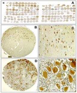 Immunohistochemistry-Paraffin: Bax inhibitor 1 Antibody (20F565) [NBP2-24912] - analysis of Bi-1 using Bi-1 antibody at 5 ug/ml: A) overview of stained human and mouse TMA, B-C) immunoreactivity in human archicortex (positive neurons of hippocampal gyrus) at 200X and 400X, D-E) strong immunoreactivity in neurons of human dorsal root ganglion.