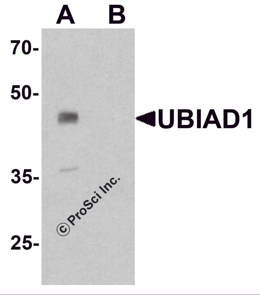 Western blot analysis of UBIAD1 in mouse liver tissue lysate with UBIAD1 antibody at 1 μg/ml in (A) the absence and (B) the presence of blocking peptide.