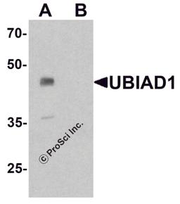 Western blot analysis of UBIAD1 in mouse liver tissue lysate with UBIAD1 antibody at 1 μg/ml in (A) the absence and (B) the presence of blocking peptide.