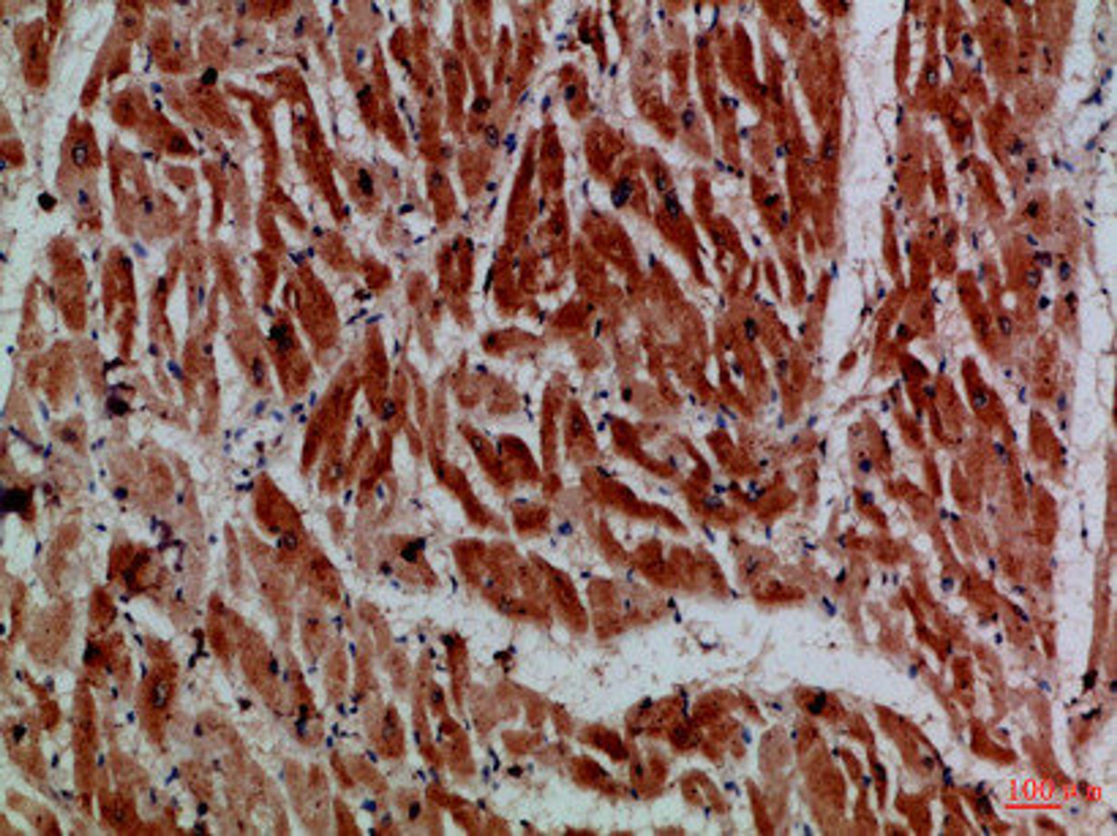 Immunohistochemical analysis of paraffin-embedded Human-heart, antibody was diluted at 1:100