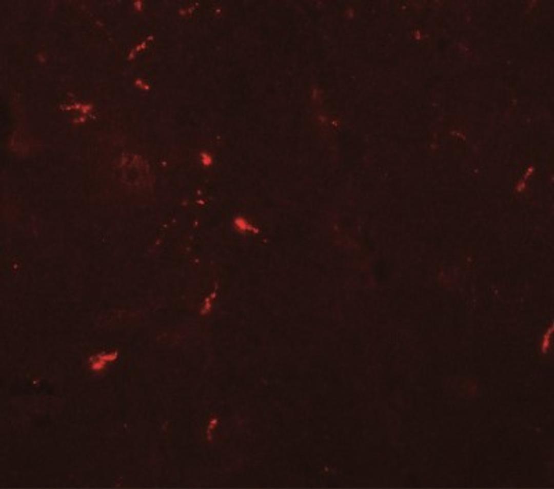 Immunocytochemistry/Immunofluorescence: Draxin/C1orf187 Antibody [NBP2-41135] - Immunofluorescence of NEUCRIN in mouse brain tissue with NEUCRIN antibody at 20 ug/mL.