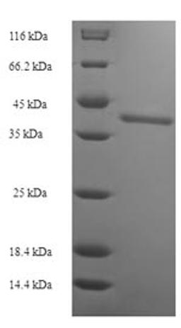 (Tris-Glycine gel) Discontinuous SDS-PAGE (reduced) with 5% enrichment gel and 15% separation gel.