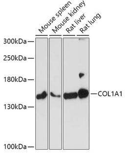 Western blot - COL1A1 antibody (A1352)