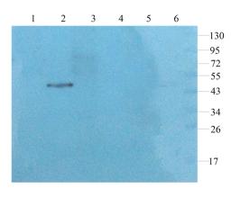 WB analysis of rat brain (lane 1), rat spinal cord (lane 2), rat lung (lane 3), mouse pancreas (lane 4), rat liver (lane 5), U251 cells (lane 6) using GFAP antibody (1 ug/ml)