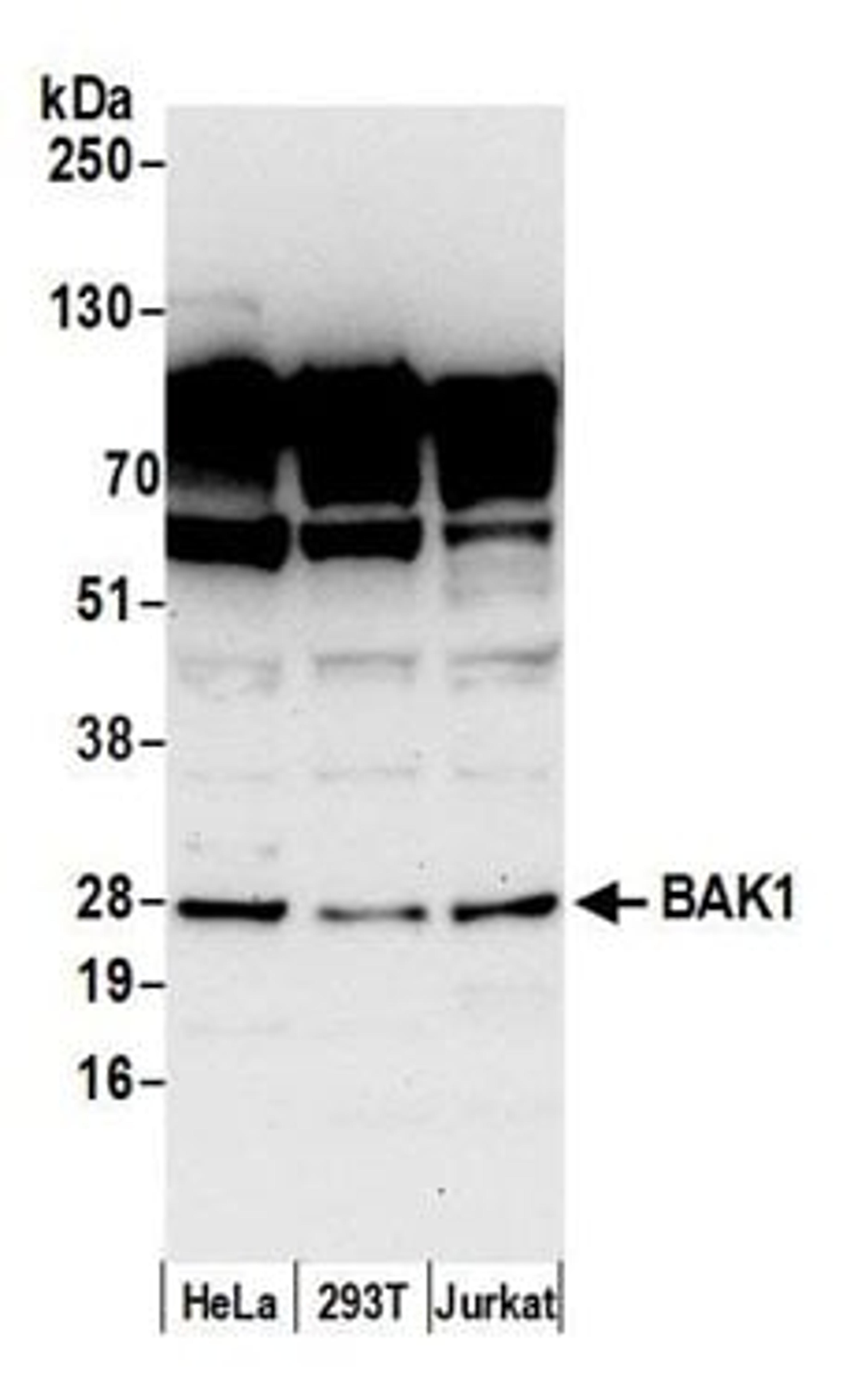 Detection of human BAK1 by western blot.