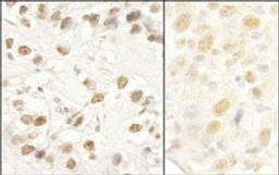 Detection of human and mouse CROP/Luc7A by immunohistochemistry.