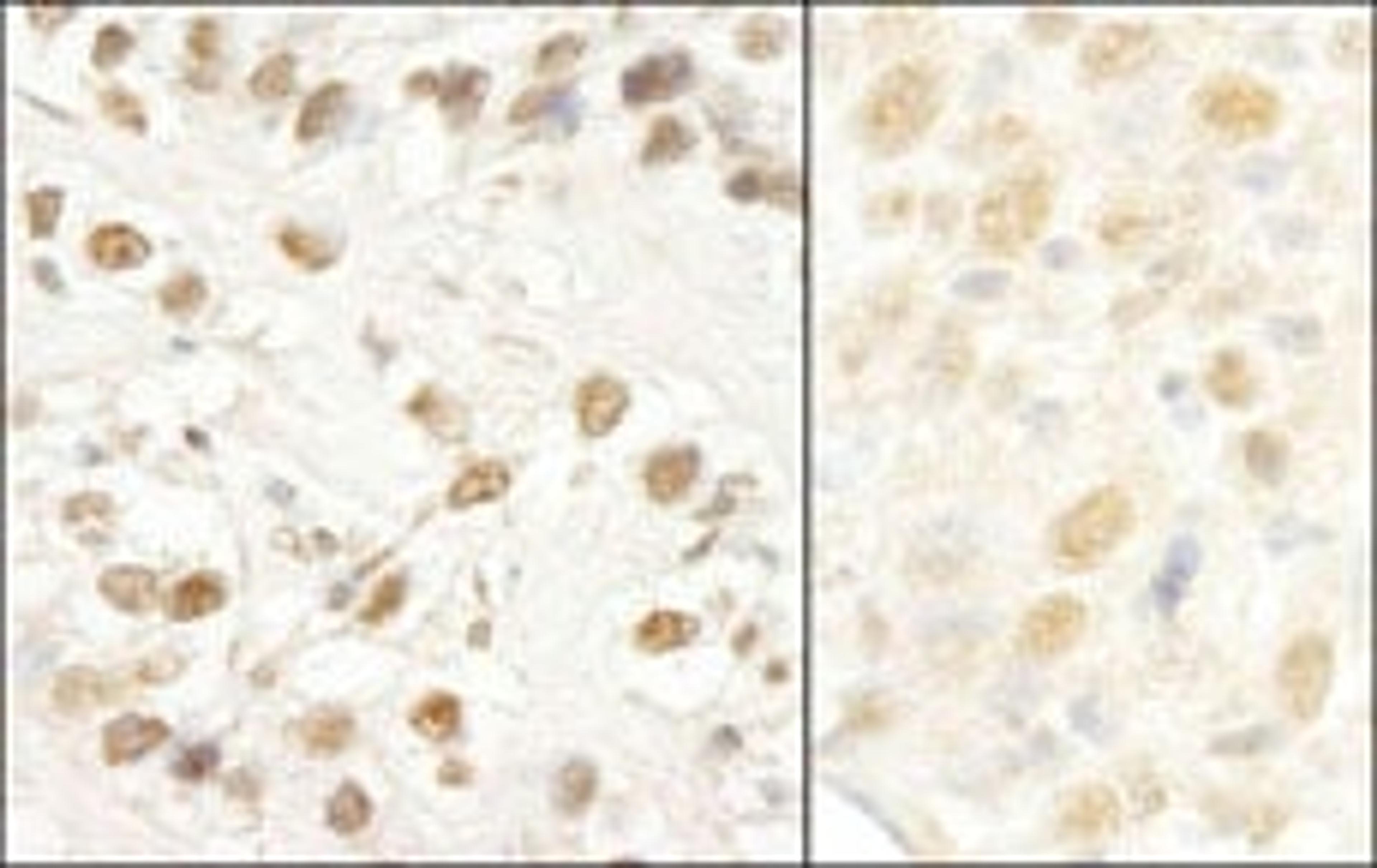 Detection of human and mouse CROP/Luc7A by immunohistochemistry.