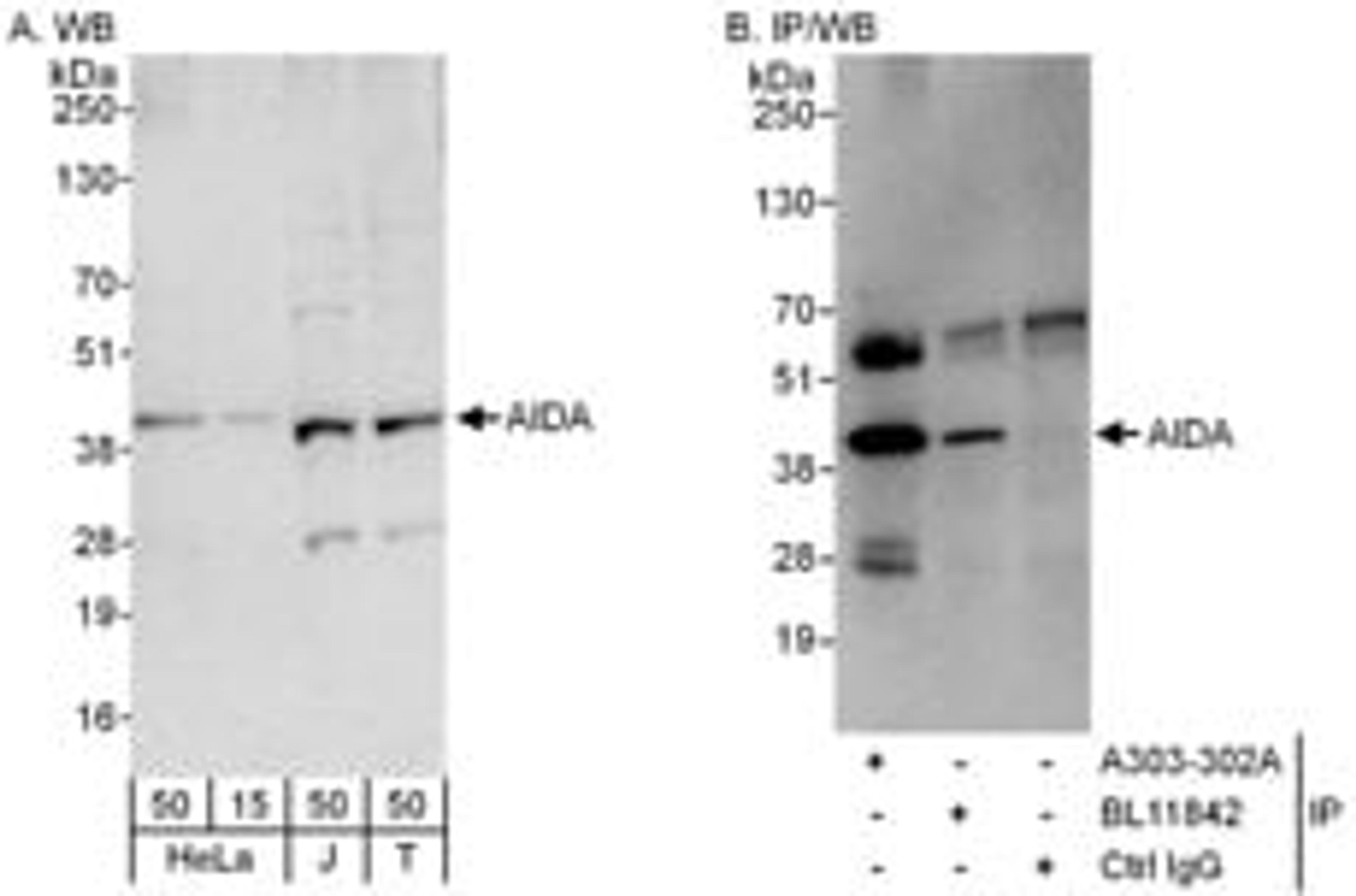 Detection of human AIDA by western blot and immunoprecipitation.