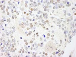 Detection of mouse ANKS3 by immunohistochemistry.