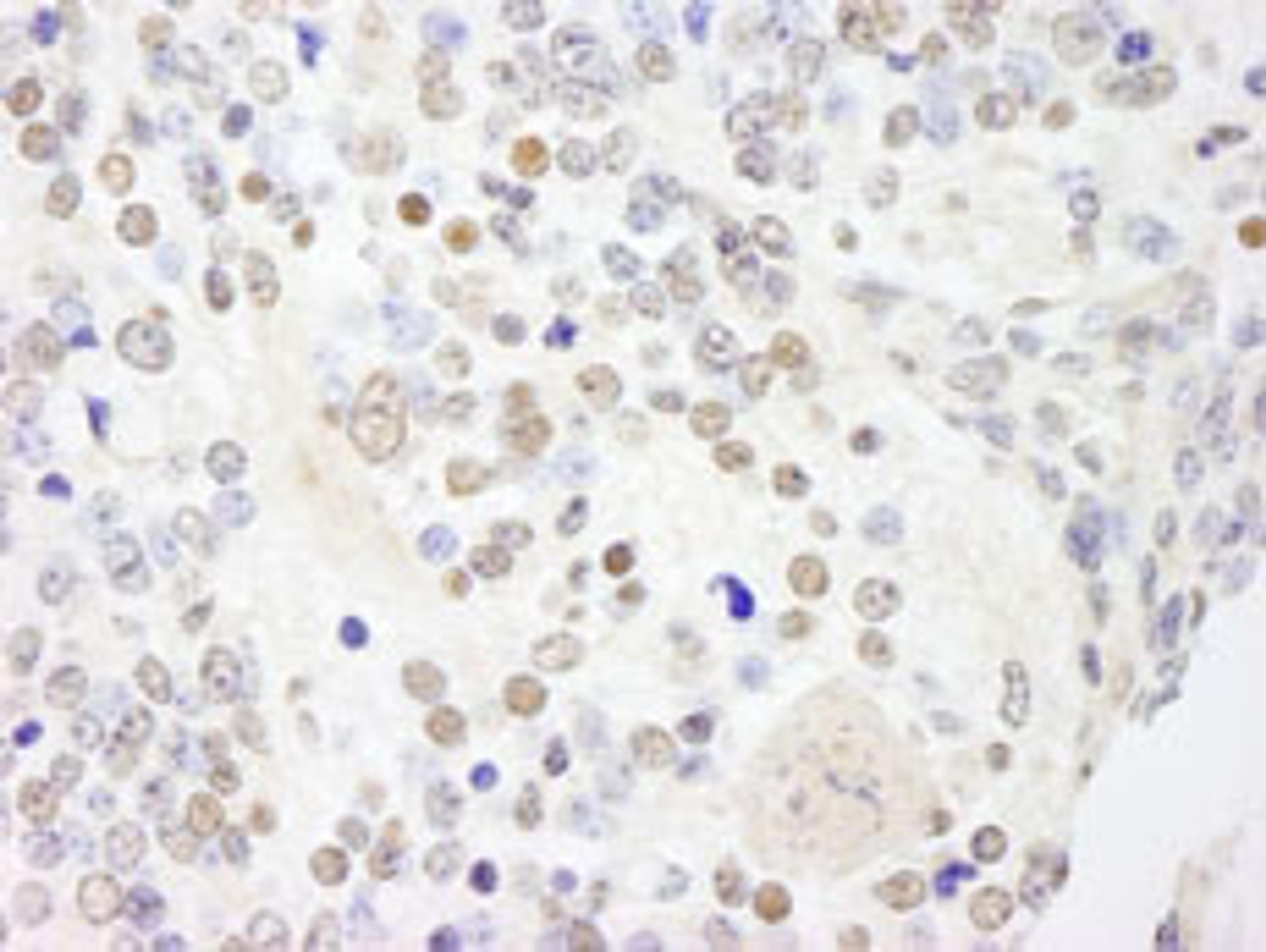 Detection of mouse ANKS3 by immunohistochemistry.