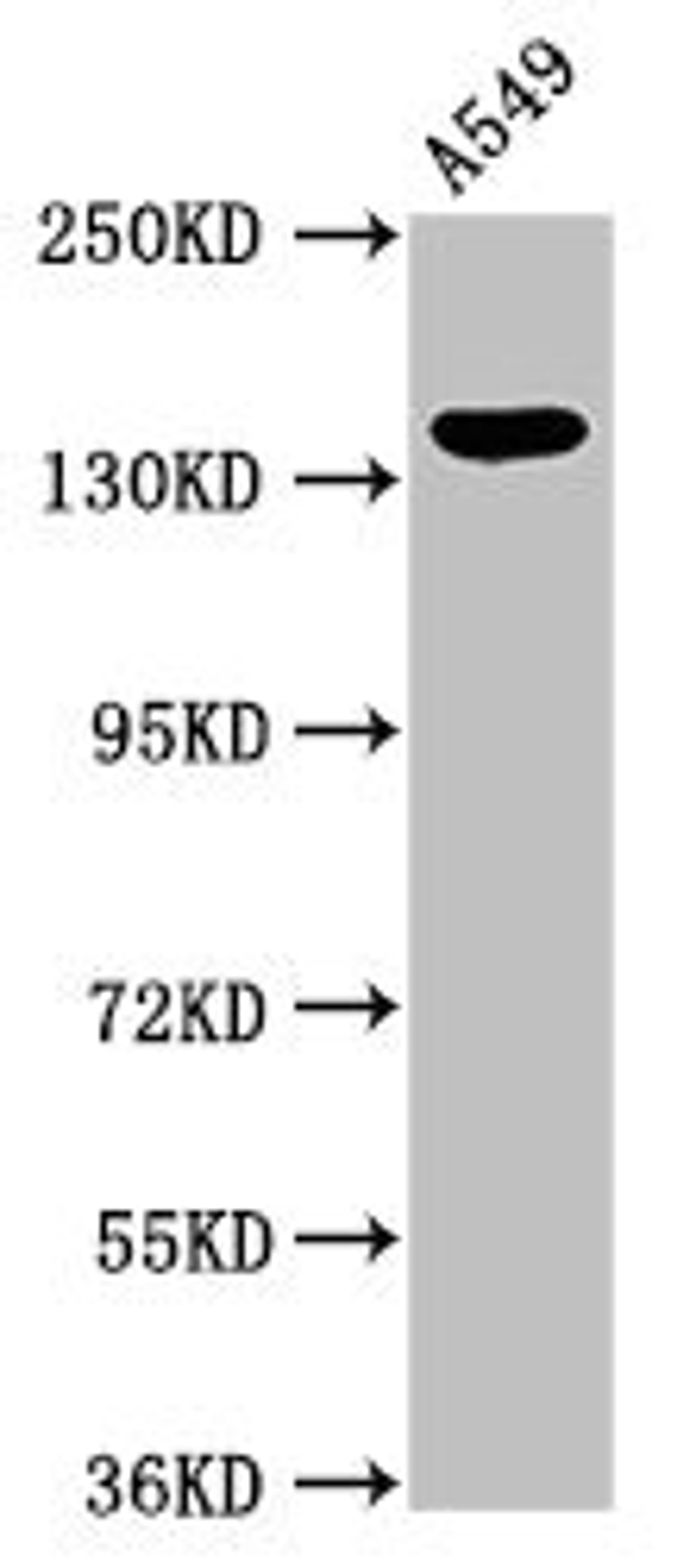 Western Blot. Positive WB detected in: A549 whole cell lysate. All lanes: PLIN4 antibody at 2.7ug/ml. Secondary. Goat polyclonal to rabbit IgG at 1/50000 dilution. Predicted band size: 135, 141 kDa. Observed band size: 135 kDa.