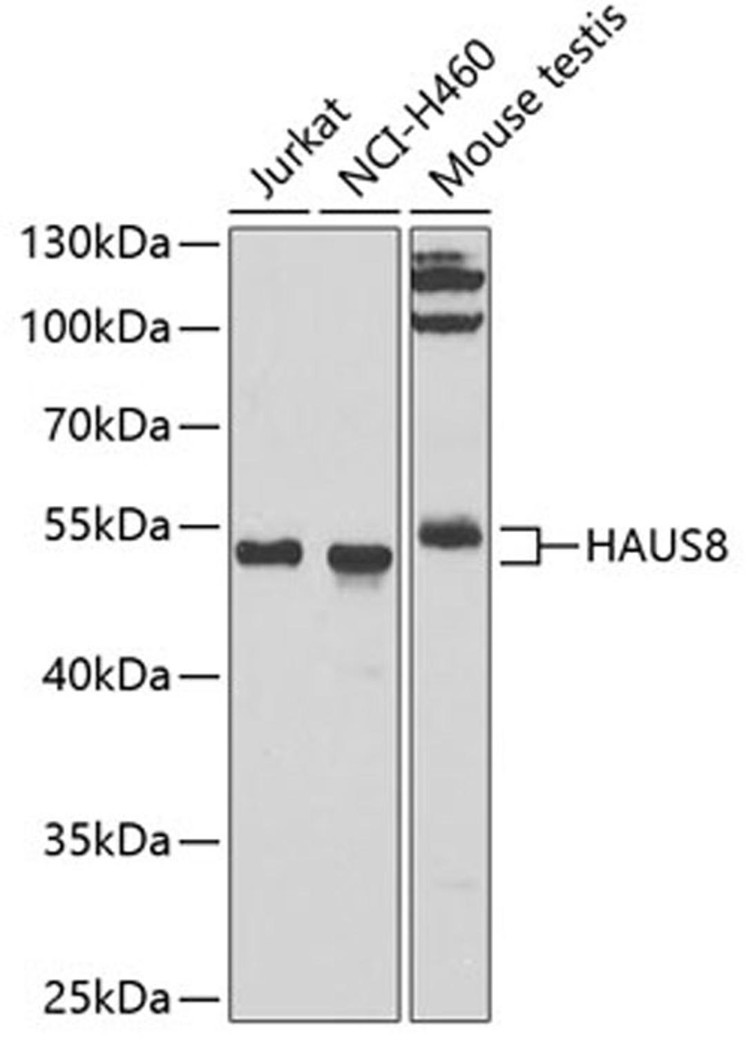 Western blot - HAUS8 antibody (A7847)