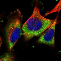 Immunocytochemistry/Immunofluorescence: C6orf154 Antibody [NBP1-91736] - Staining of human cell line U-251 MG shows positivity in cytoplasm.