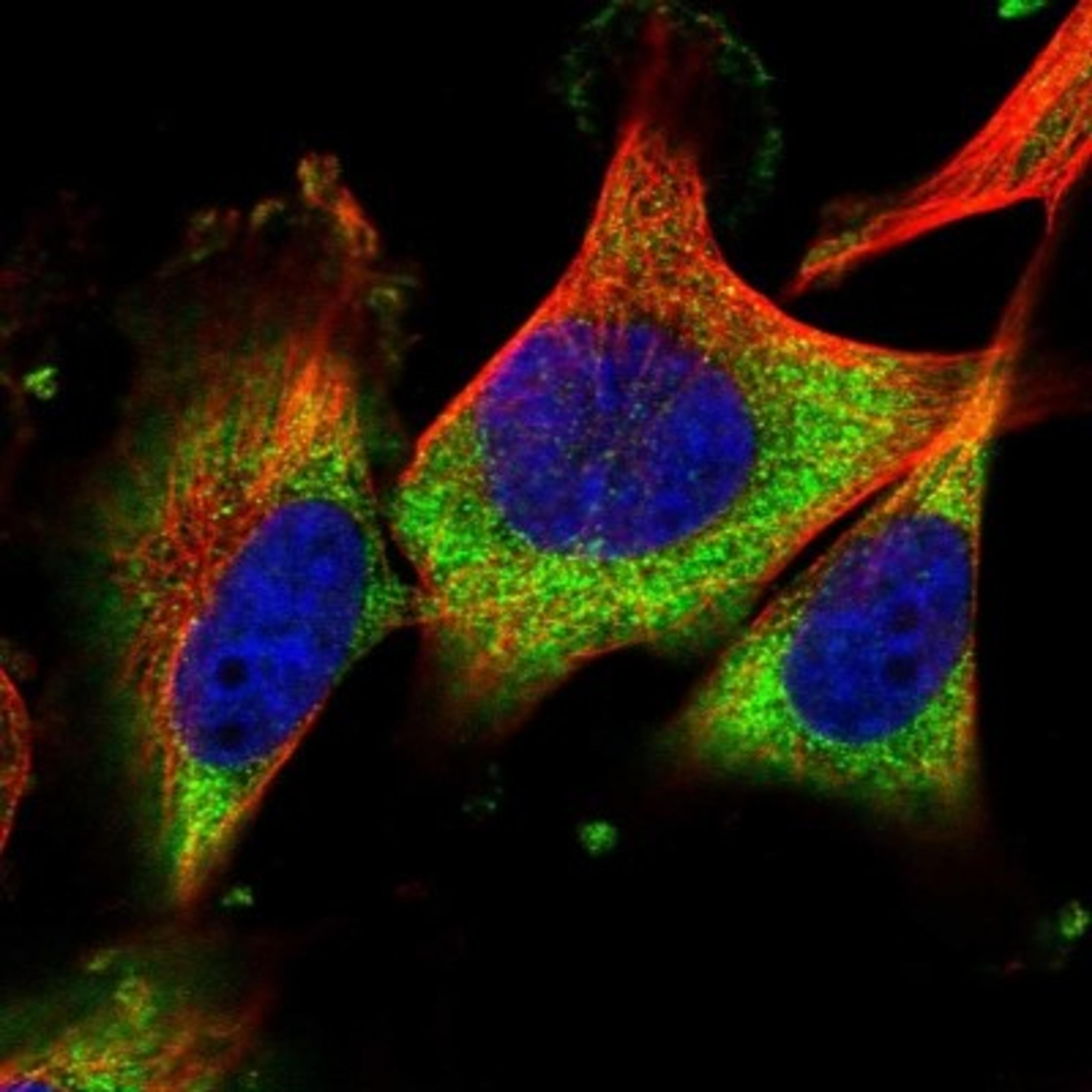 Immunocytochemistry/Immunofluorescence: C6orf154 Antibody [NBP1-91736] - Staining of human cell line U-251 MG shows positivity in cytoplasm.