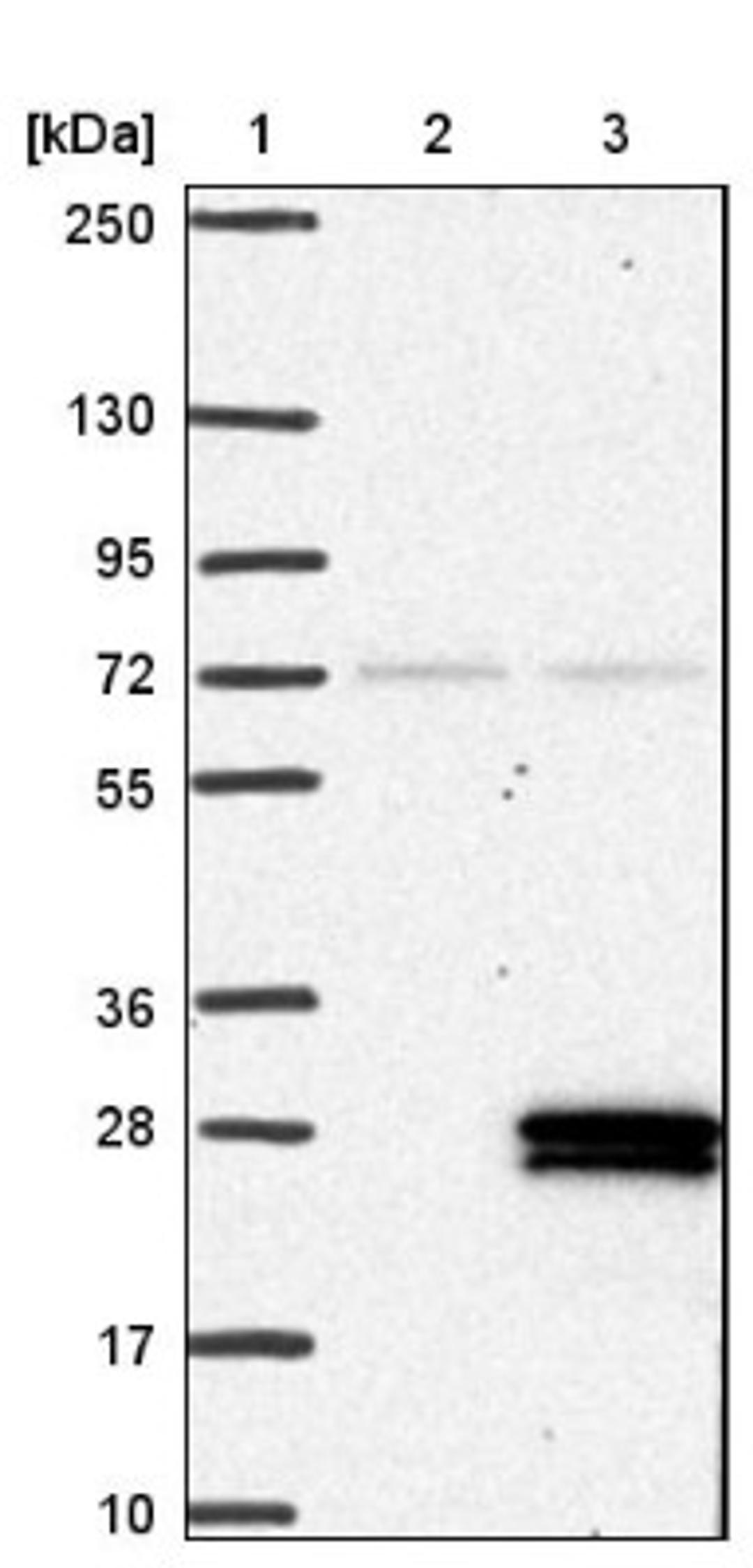 Western Blot: COX IV Isoform 2 Antibody [NBP1-88058] - Lane 1: Marker [kDa] 250, 130, 95, 72, 55, 36, 28, 17, 10<br/>Lane 2: Negative control (vector only transfected HEK293T lysate)<br/>Lane 3: Over-expression lysate (Co-expressed with a C-terminal myc-DDK tag (~3.1 kDa) in mammalian HEK293T cells, LY410005)