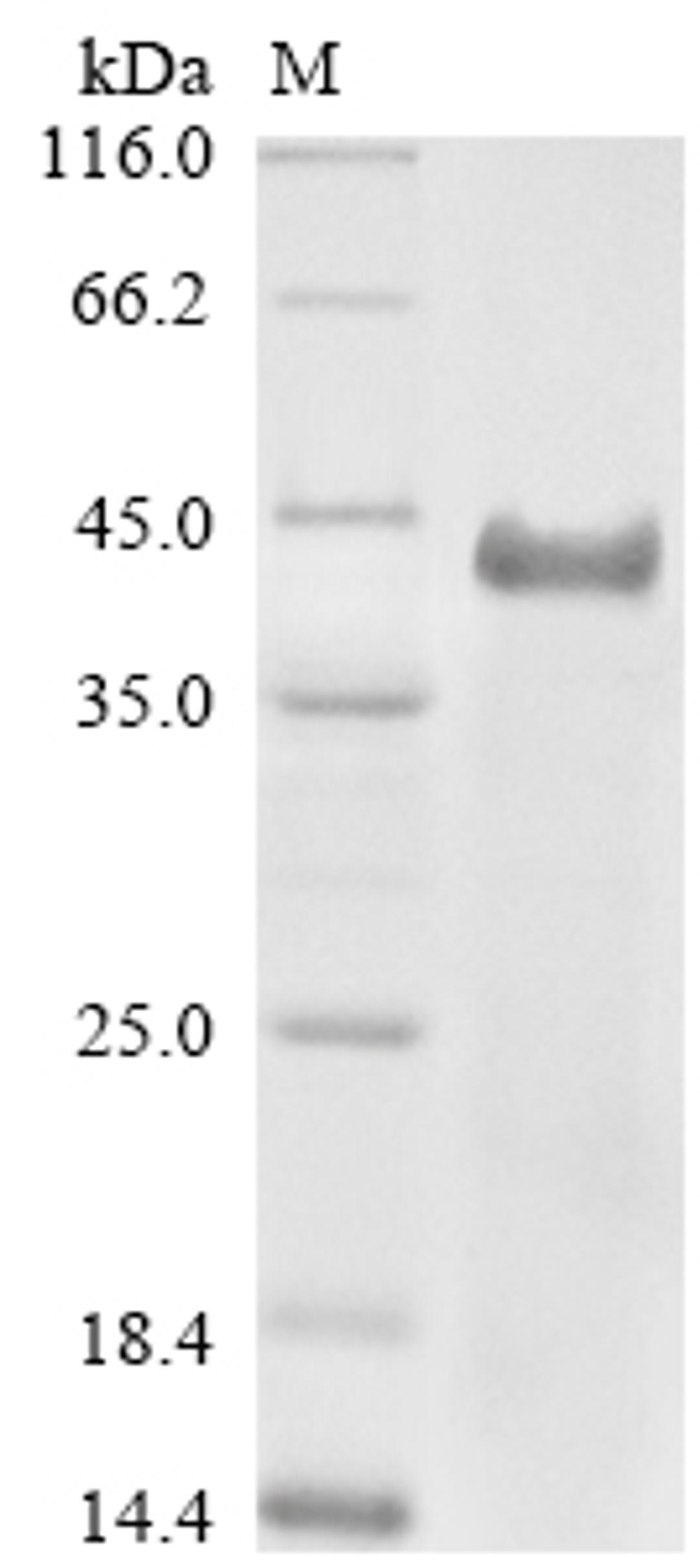 (Tris-Glycine gel) Discontinuous SDS-PAGE (reduced) with 5% enrichment gel and 15% separation gel.
