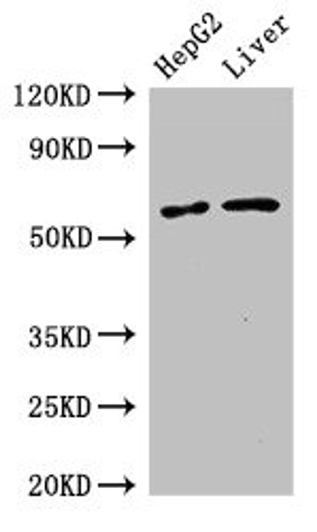 Western Blot. Positive WB detected in: HepG2 whole cell lysate, Mouse liver tissue. All lanes: SLC2A9 antibody at 2.7µg/ml. Secondary. Goat polyclonal to rabbit IgG at 1/50000 dilution. Predicted band size: 59, 56 kDa. Observed band size: 59 kDa