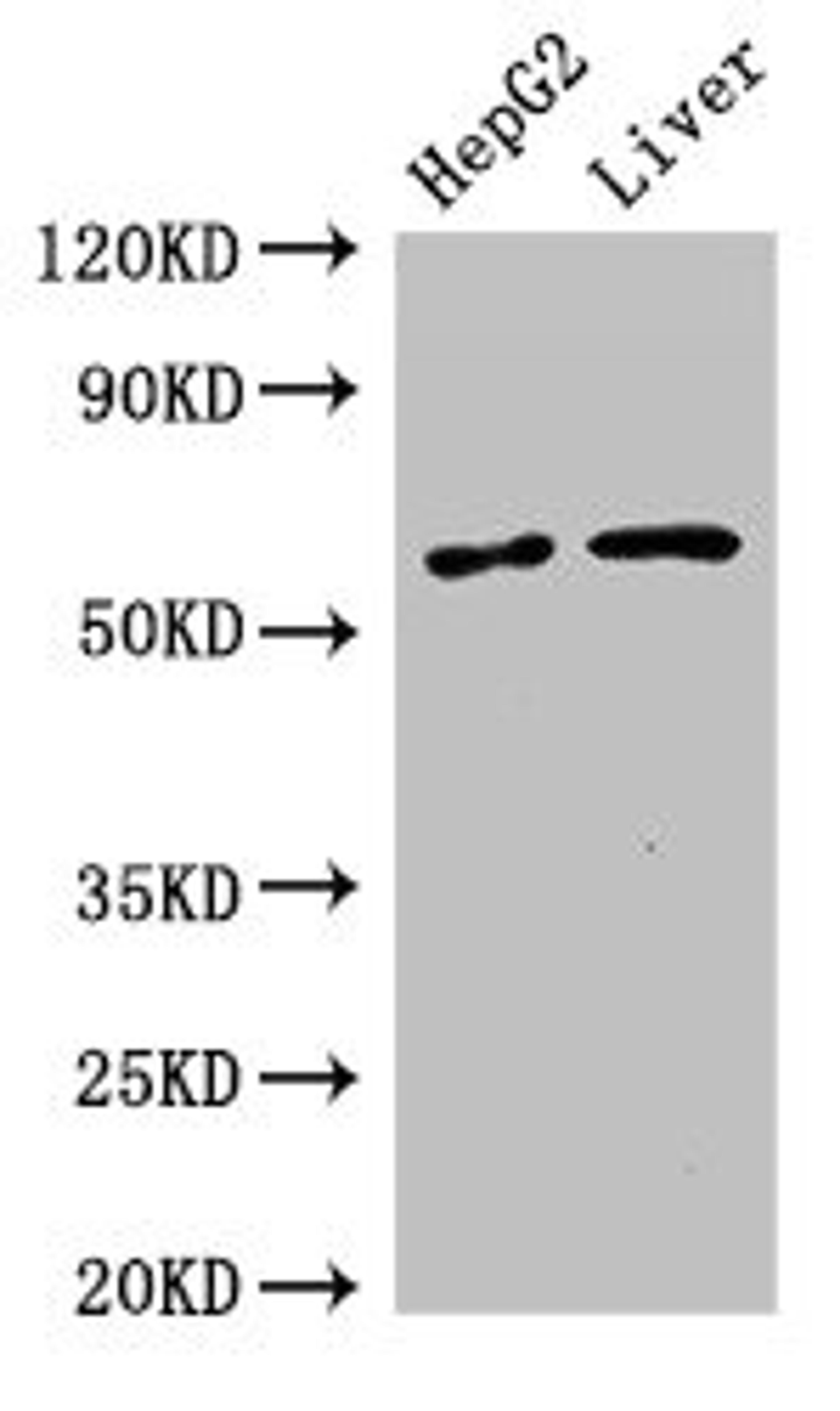 Western Blot. Positive WB detected in: HepG2 whole cell lysate, Mouse liver tissue. All lanes: SLC2A9 antibody at 2.7µg/ml. Secondary. Goat polyclonal to rabbit IgG at 1/50000 dilution. Predicted band size: 59, 56 kDa. Observed band size: 59 kDa
