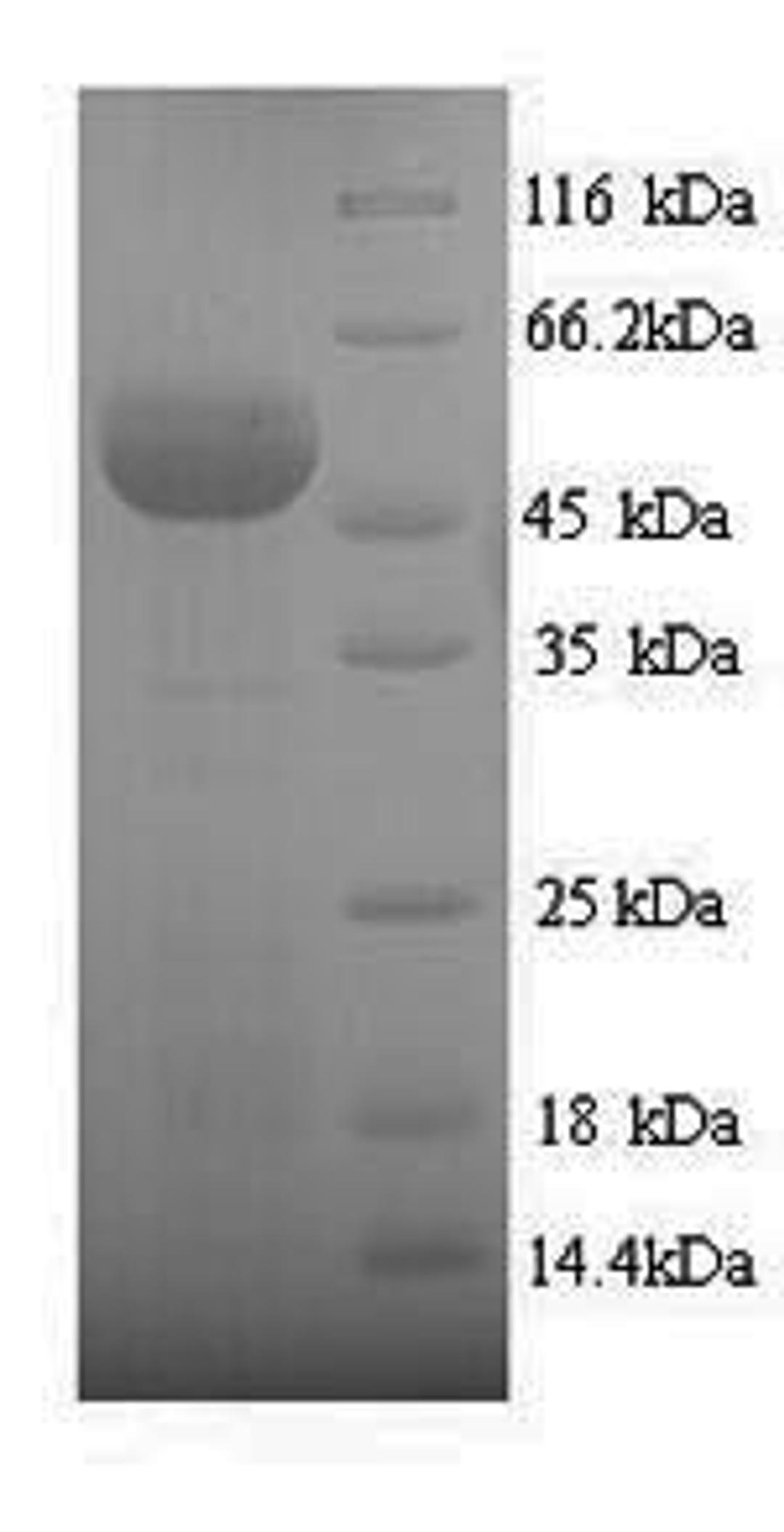 (Tris-Glycine gel) Discontinuous SDS-PAGE (reduced) with 5% enrichment gel and 15% separation gel.