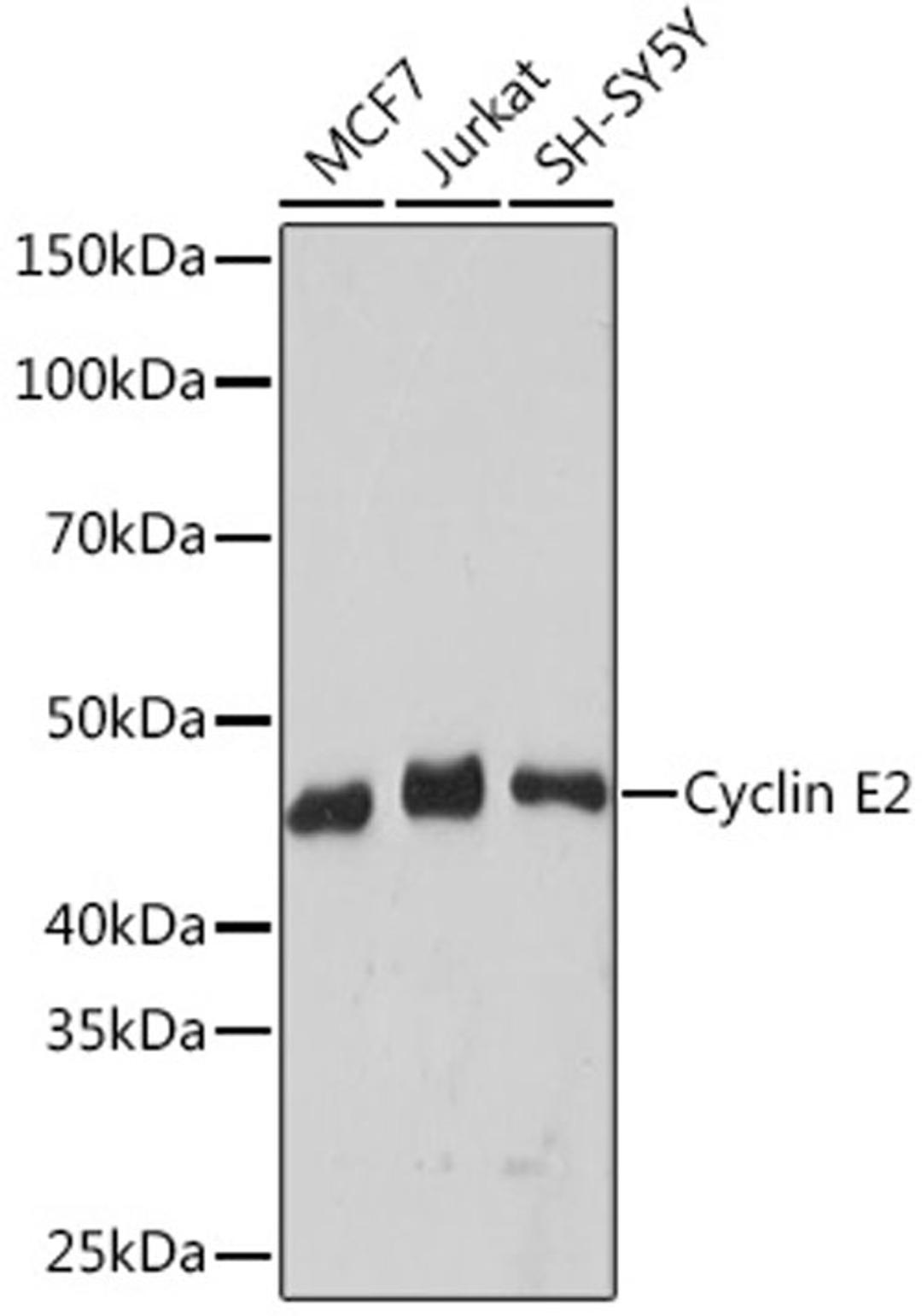 Western blot - Cyclin E2 Rabbit mAb (A9305)