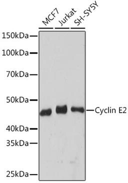 Western blot - Cyclin E2 Rabbit mAb (A9305)