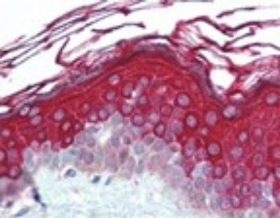 Immunohistochemistry-Paraffin: Alas1 Antibody [NB100-56415] - Staining at 5 ug/ml. Heat induced antigen retrieval in pH 6.0 citrate buffer was used for unmasking. A biotinylated secondary antibody followed by alkaline phosphatase-streptavidin was and chromogen was used for detection.