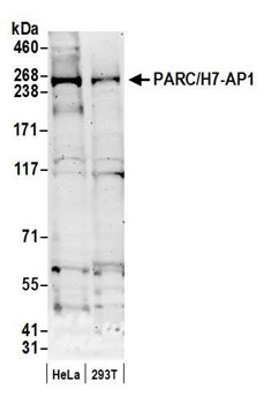 Detection of human PARC/H7-AP1 by western blot.