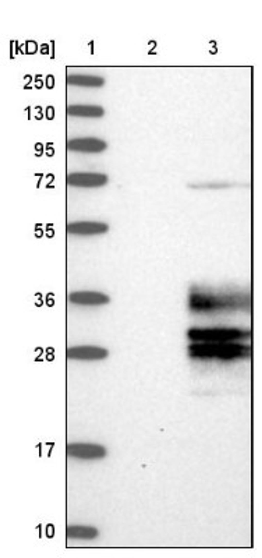 Western Blot: CLRN3 Antibody [NBP1-81119] - Lane 1: Marker [kDa] 250, 130, 95, 72, 55, 36, 28, 17, 10<br/>Lane 2: Negative control (vector only transfected HEK293T lysate)<br/>Lane 3: Over-expression lysate (Co-expressed with a C-terminal myc-DDK tag (~3.1 kDa) in mammalian HEK293T cells, LY407638)