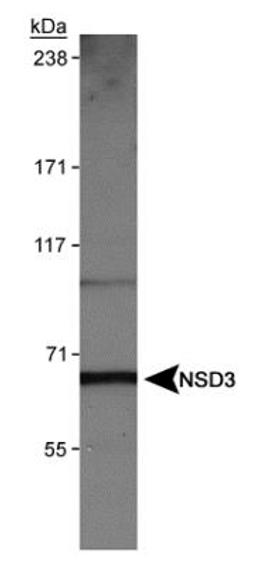 Western Blot: NSD3 Antibody [NBP1-04991] - Detection of NSD3 (isoform 3) in HeLa nuclear extracts using NBP1-04991.