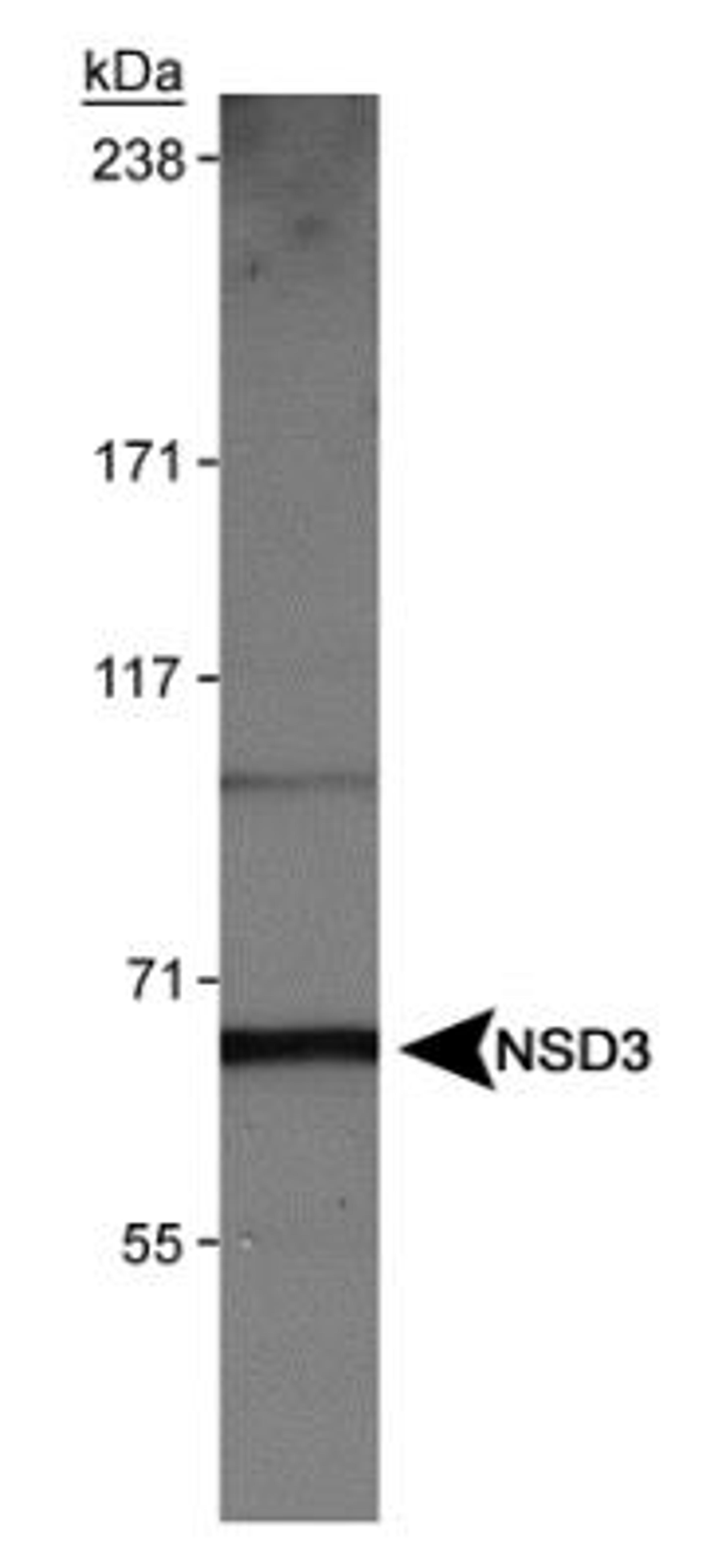 Western Blot: NSD3 Antibody [NBP1-04991] - Detection of NSD3 (isoform 3) in HeLa nuclear extracts using NBP1-04991.