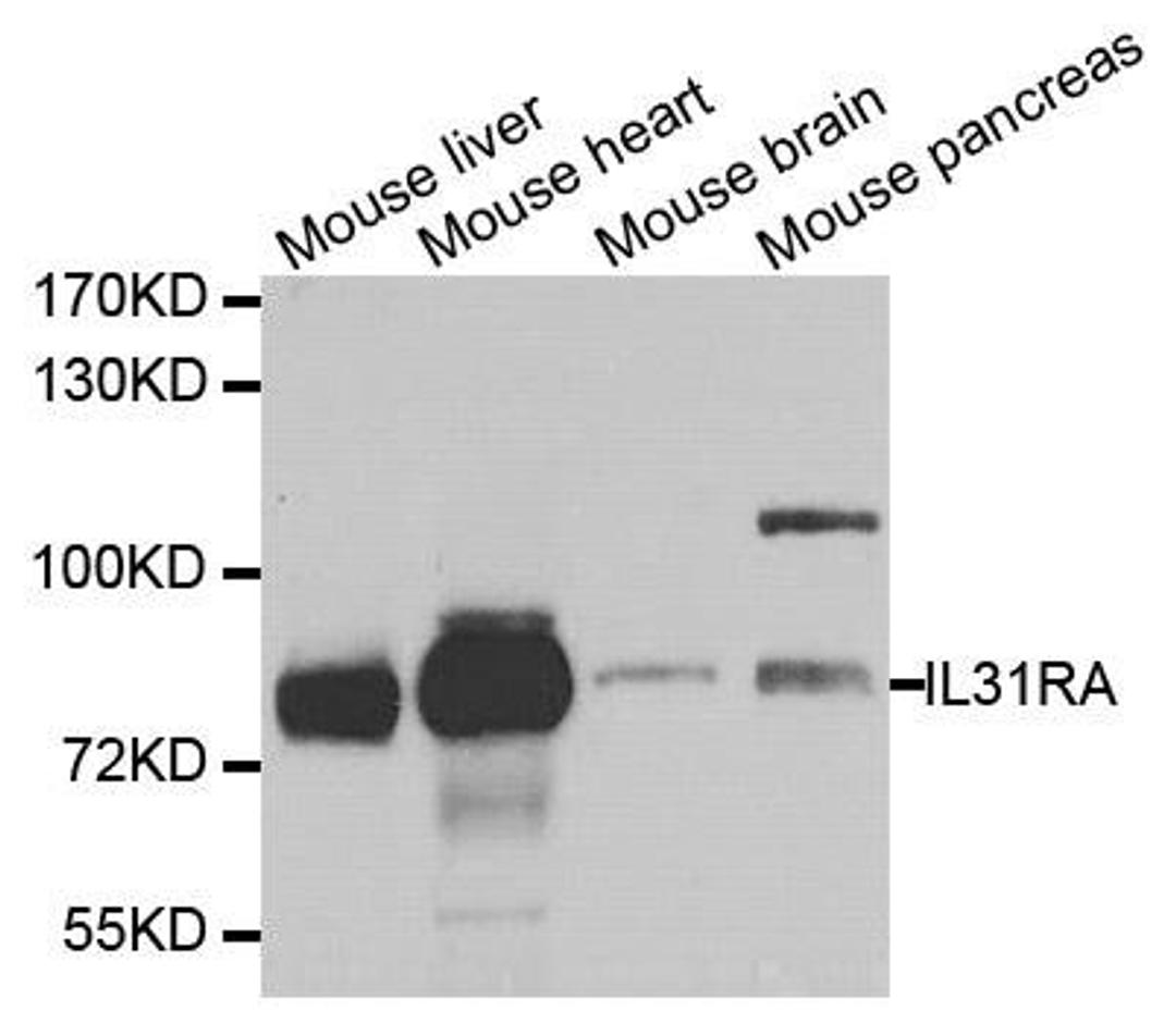 Western blot analysis of extracts of various cell lines using IL31RA antibody