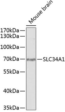 Western blot - SLC34A1 antibody (A13634)