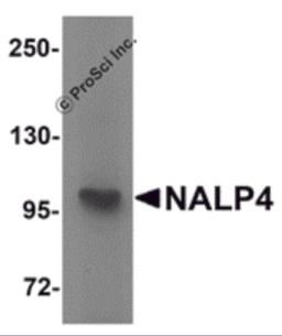 Western blot analysis of NALP4 in K562 cell lysate with NALP4 antibody at 1 &#956;g/mL.