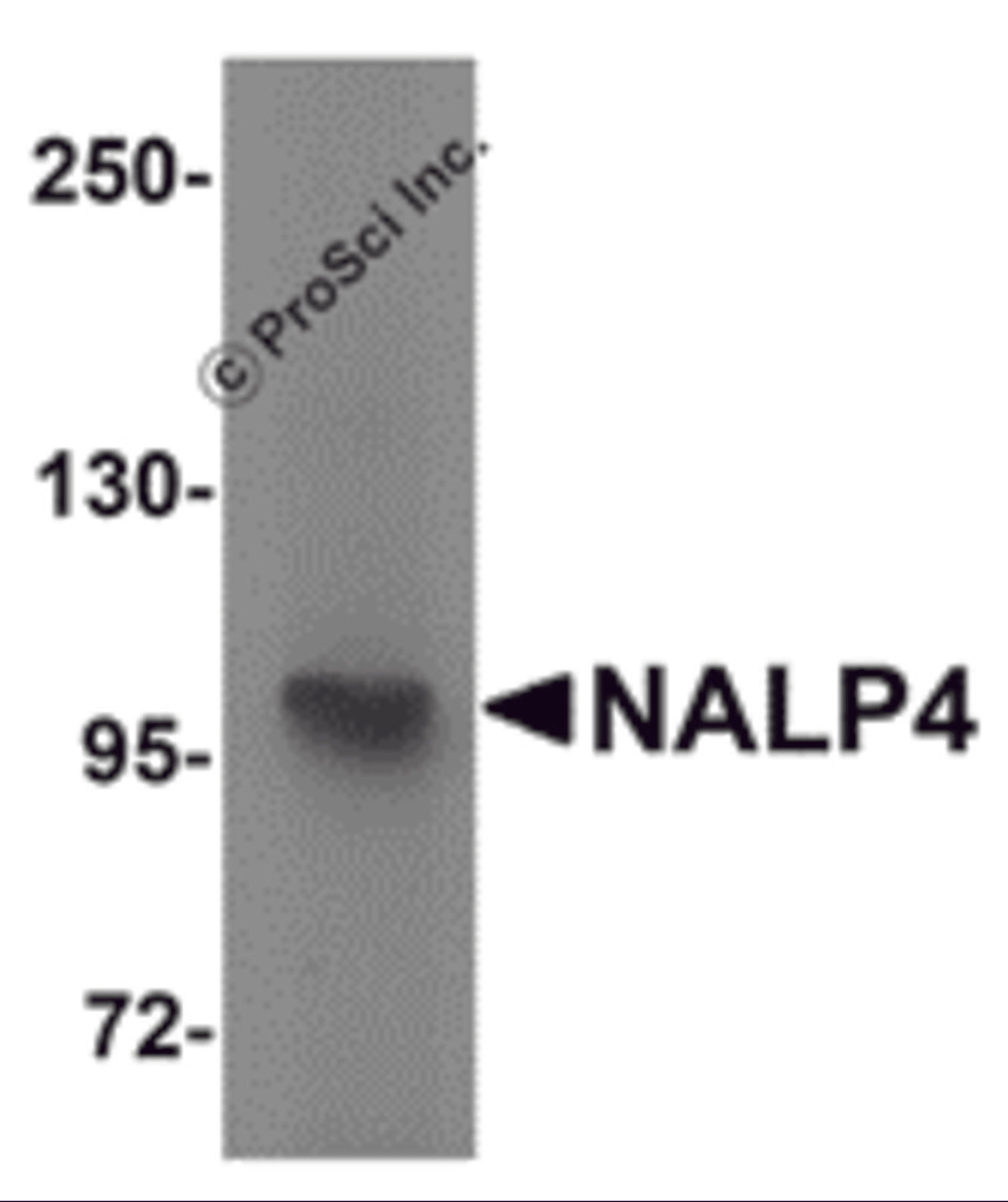 Western blot analysis of NALP4 in K562 cell lysate with NALP4 antibody at 1 μg/mL.