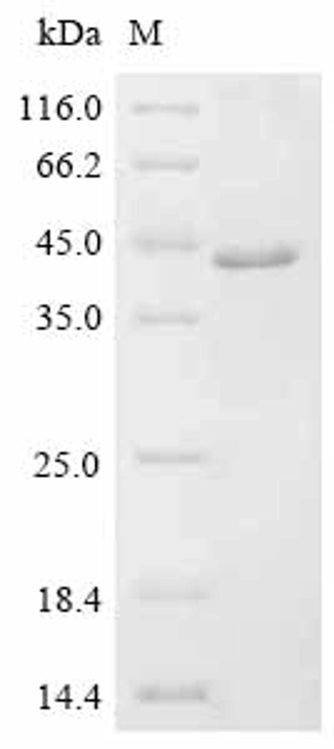(Tris-Glycine gel) Discontinuous SDS-PAGE (reduced) with 5% enrichment gel and 15% separation gel.