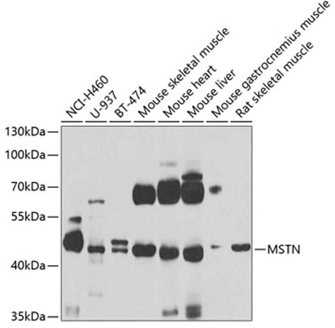 Western blot - MSTN antibody (A6913)