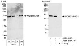 Detection of human WDHD1/AND-1 by western blot and immunoprecipitation.